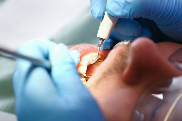 Best Emergency Dentist for Knocked-Out Tooth in Peebles, OH